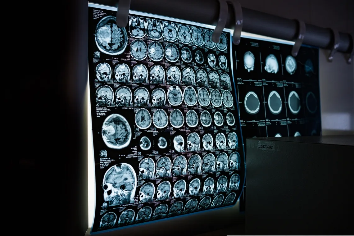 Featured image of post Neurologie Spilburg